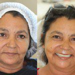 Rosto antes e depois