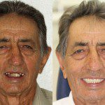 Rosto antes e depois