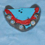 Guia cirúrgico para cirurgia guiada