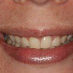 Daniela - Após 7 dias