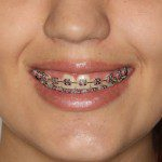 Jennifer - Meia face depois