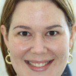 Daniela - Face antes